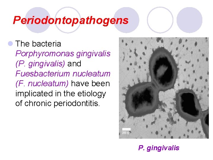 Periodontopathogens l The bacteria Porphyromonas gingivalis (P. gingivalis) and Fuesbacterium nucleatum (F. nucleatum) have