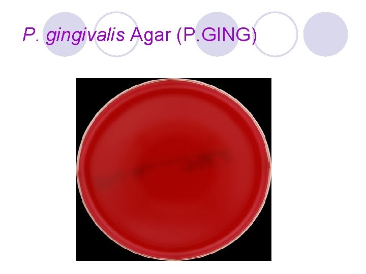 P. gingivalis Agar (P. GING) 