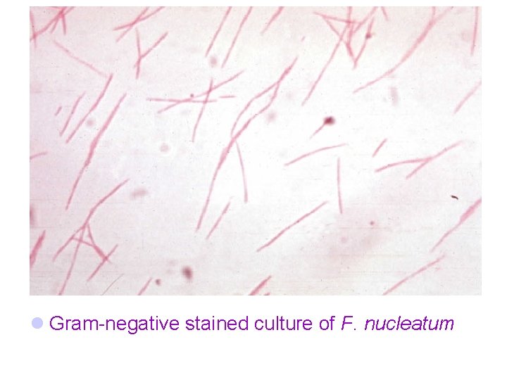 l Gram-negative stained culture of F. nucleatum 