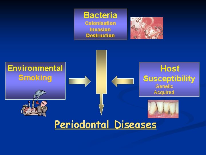 Bacteria Colonisation Invasion Destruction Environmental Smoking Host Susceptibility Genetic Acquired Periodontal Diseases 