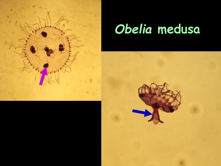 Obelia medusa 