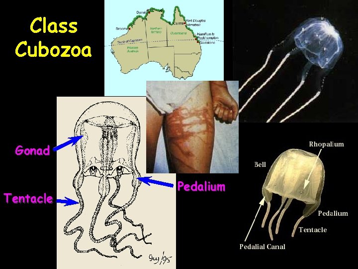 Class Cubozoa Gonad Tentacle Pedalium 