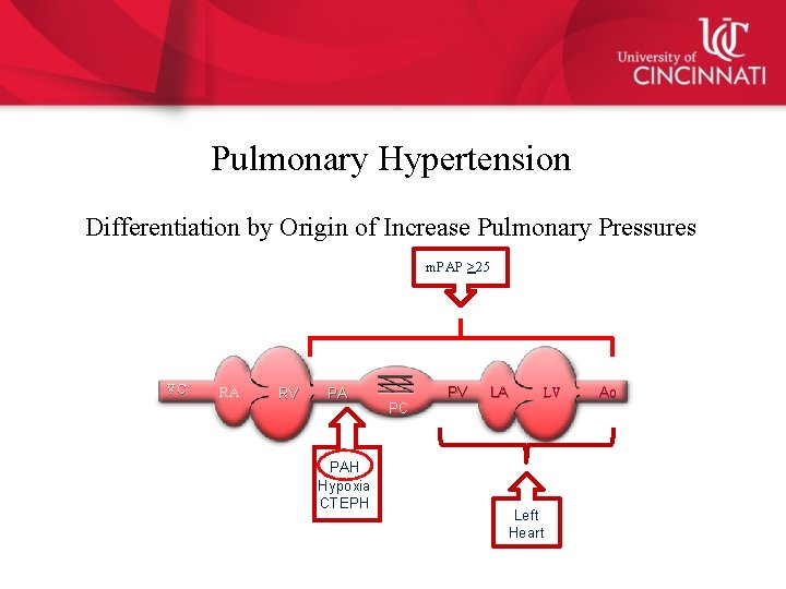 Pulmonary Hypertension Differentiation by Origin of Increase Pulmonary Pressures m. PAP >25 VC RA