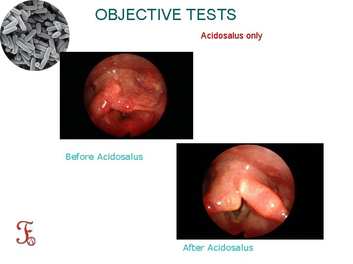 OBJECTIVE TESTS Acidosalus only Before Acidosalus After Acidosalus 