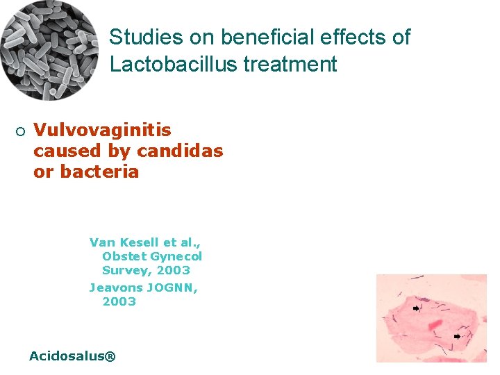 Studies on beneficial effects of Lactobacillus treatment ¡ Vulvovaginitis caused by candidas or bacteria