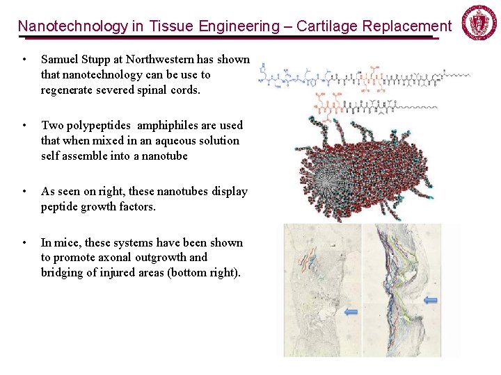 Nanotechnology in Tissue Engineering – Cartilage Replacement • Samuel Stupp at Northwestern has shown Nanotechnology in Tissue Engineering – Cartilage Replacement • Samuel Stupp at Northwestern has shown