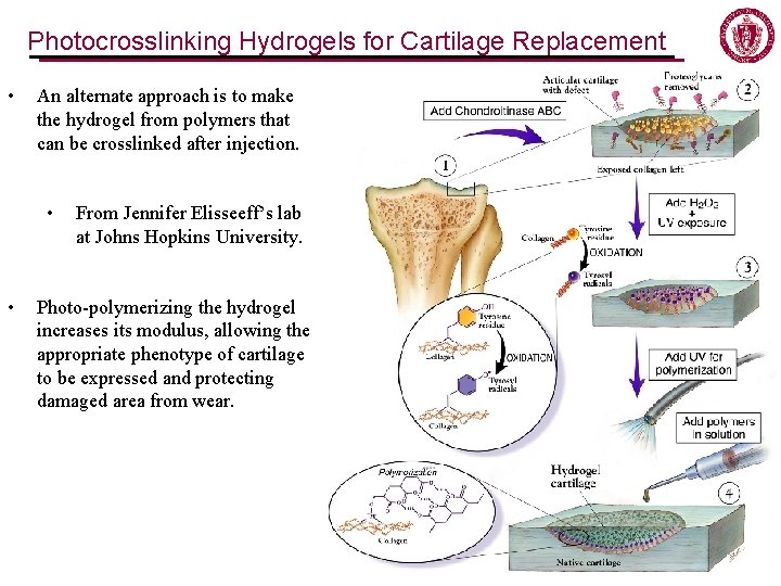 Photocrosslinking Hydrogels for Cartilage Replacement • An alternate approach is to make the hydrogel Photocrosslinking Hydrogels for Cartilage Replacement • An alternate approach is to make the hydrogel