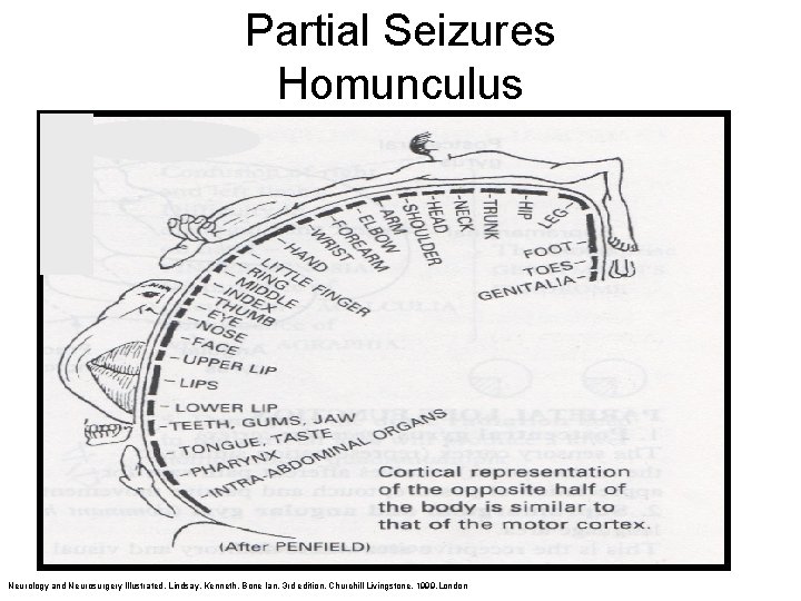 Partial Seizures Homunculus Neurology and Neurosurgery Illustrated. Lindsay, Kenneth, Bone Ian, 3 rd edition.
