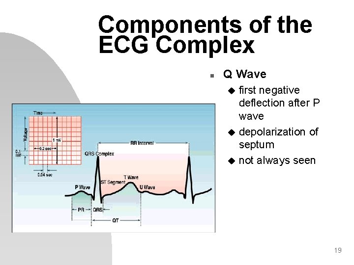 Components of the ECG Complex n Q Wave first negative deflection after P wave