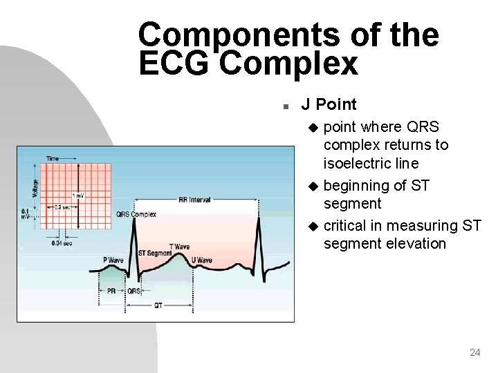 Components of the ECG Complex n J Point point where QRS complex returns to