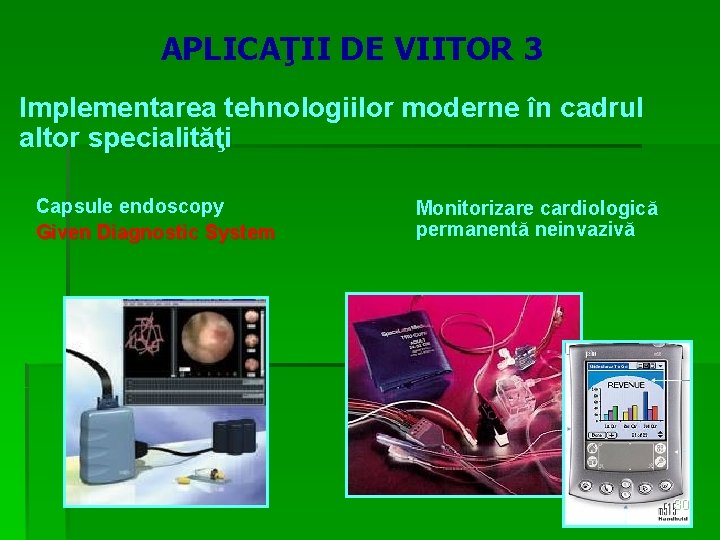 APLICAŢII DE VIITOR 3 Implementarea tehnologiilor moderne în cadrul altor specialităţi Capsule endoscopy Given