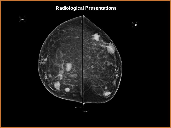 Radiological Presentations 