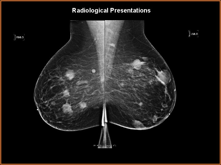 Radiological Presentations 
