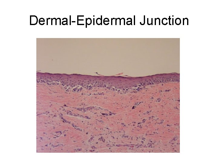 Dermal-Epidermal Junction 