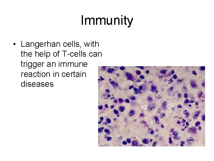 Immunity • Langerhan cells, with the help of T-cells can trigger an immune reaction