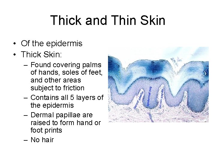 Thick and Thin Skin • Of the epidermis • Thick Skin: – Found covering