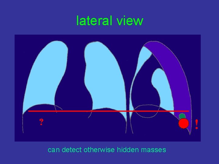 lateral view ? ! can detect otherwise hidden masses 