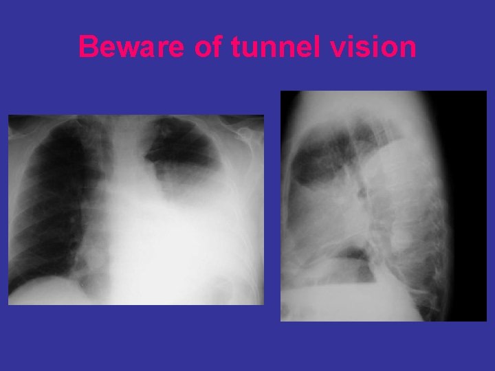 Beware of tunnel vision 