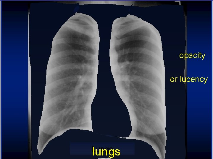  opacity or lucency lungs 