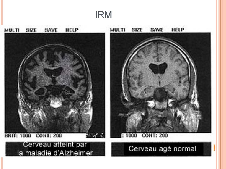 IRM 