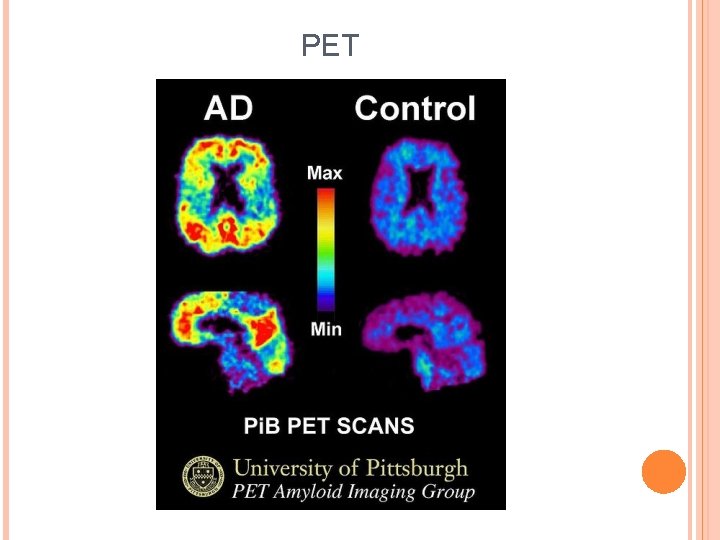 PET 