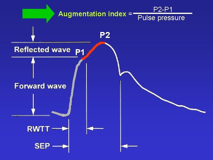 P 2 -P 1 Augmentation index = Pulse pressure P 2 P 1 