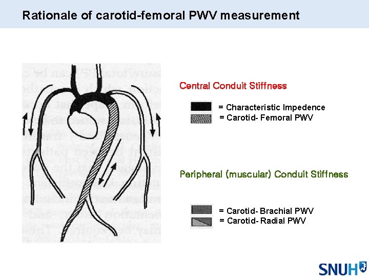 Rationale of carotid-femoral PWV measurement Central Conduit Stiffness = Characteristic Impedence = Carotid- Femoral