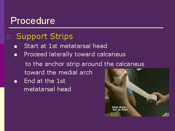 Procedure p Support Strips n n n Start at 1 st metatarsal head Proceed