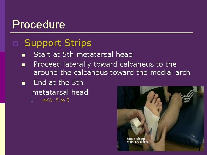 Procedure p Support Strips n n n Start at 5 th metatarsal head Proceed