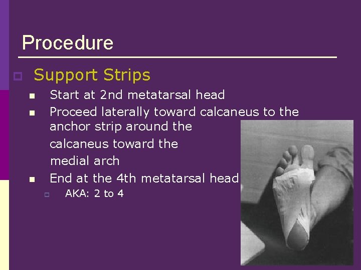 Procedure p Support Strips n n n Start at 2 nd metatarsal head Proceed