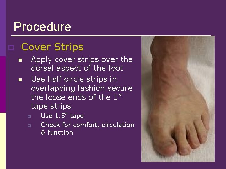 Procedure p Cover Strips n n Apply cover strips over the dorsal aspect of