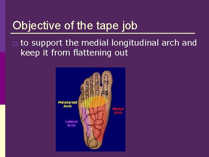 Objective of the tape job p to support the medial longitudinal arch and keep