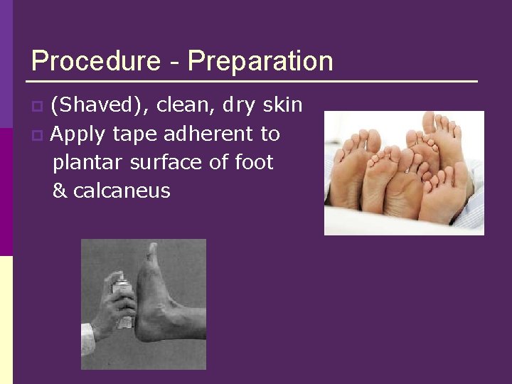 Procedure - Preparation (Shaved), clean, dry skin p Apply tape adherent to plantar surface