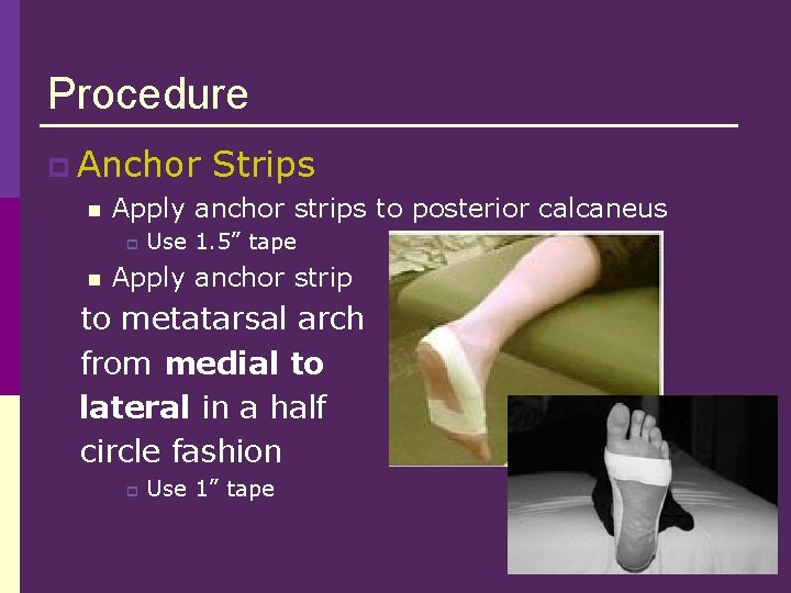Procedure p Anchor Strips n Apply anchor strips to posterior calcaneus p n Use