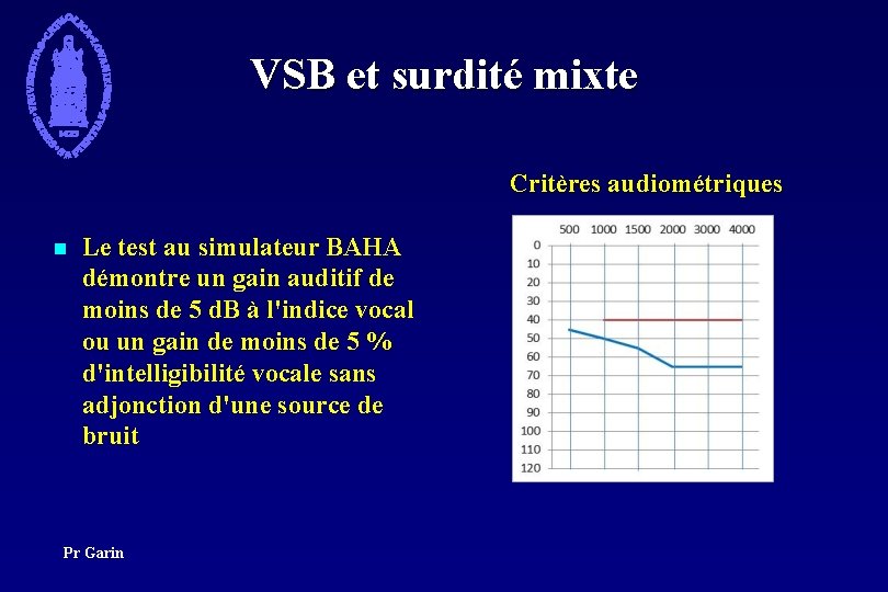 VSB et surdité mixte Critères audiométriques n Le test au simulateur BAHA démontre un