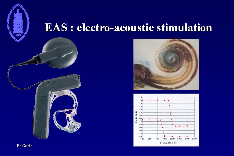 EAS : electro-acoustic stimulation Pr Garin 