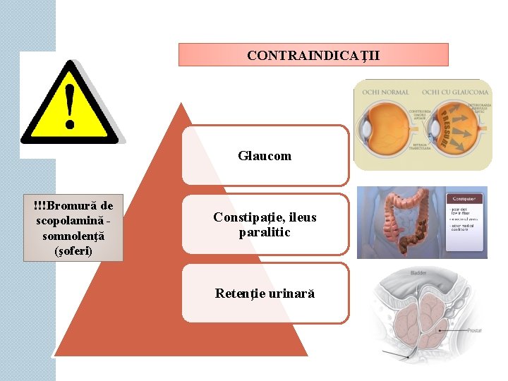 CONTRAINDICAŢII Glaucom !!!Bromură de scopolamină somnolenţă (şoferi) Constipaţie, ileus paralitic Retenţie urinară 