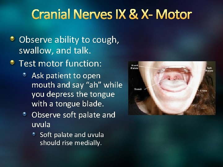 Cranial Nerves IX & X- Motor Observe ability to cough, swallow, and talk. Test