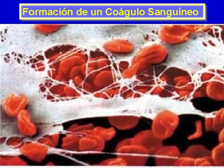 Formación de un Coágulo Sanguíneo 