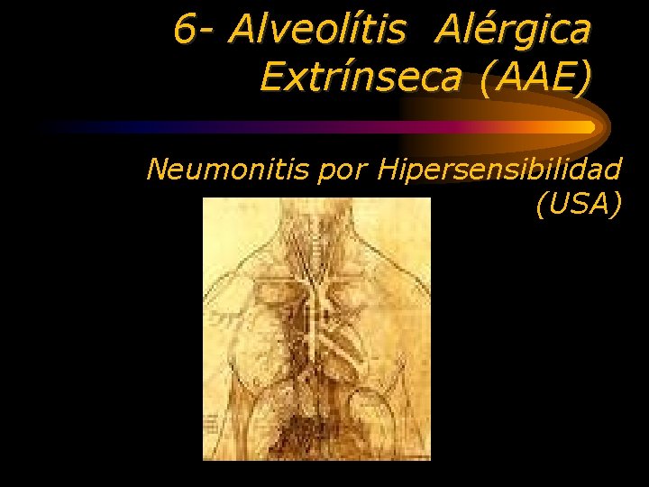 6 - Alveolítis Alérgica Extrínseca (AAE) Neumonitis por Hipersensibilidad (USA) 