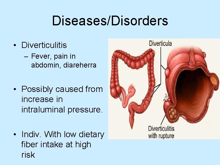 Diseases/Disorders • Diverticulitis – Fever, pain in abdomin, diareherra • Possibly caused from increase