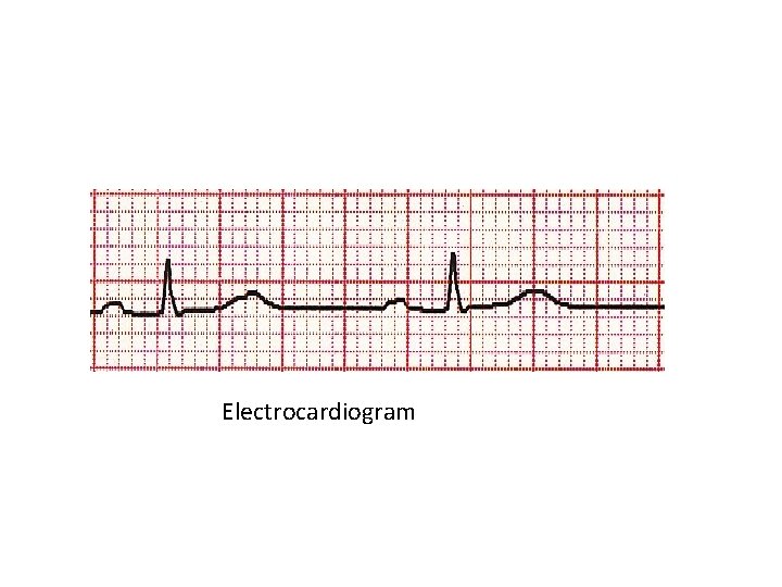 Electrocardiogram 