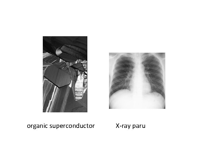 organic superconductor X-ray paru 