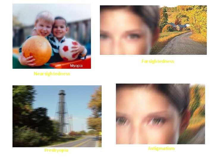 Farsightedness Nearsightedness Presbyopia Astigmatism Farsightedness Nearsightedness Presbyopia Astigmatism