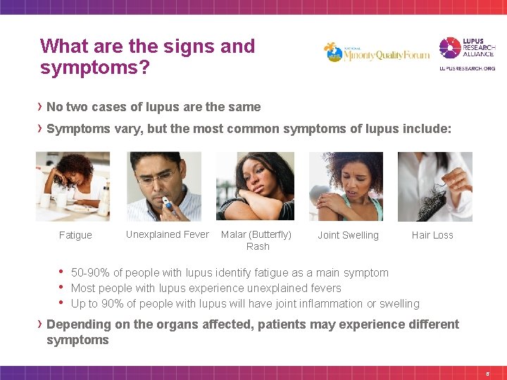 What are the signs and symptoms? › No two cases of lupus are the