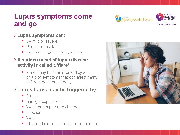 Lupus symptoms come and go › Lupus symptoms can: • • • Be mild