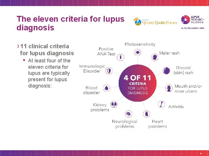 The eleven criteria for lupus diagnosis › 11 clinical criteria for lupus diagnosis •