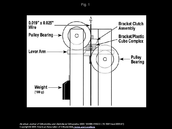 Fig. 1 American Journal of Orthodontics and Dentofacial Orthopedics 2003 123408 -415 DOI: (10.