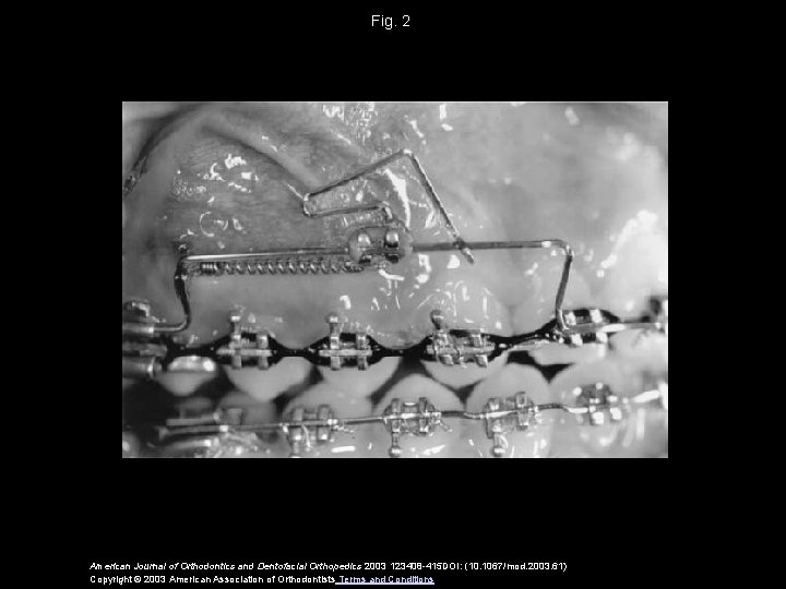 Fig. 2 American Journal of Orthodontics and Dentofacial Orthopedics 2003 123408 -415 DOI: (10.