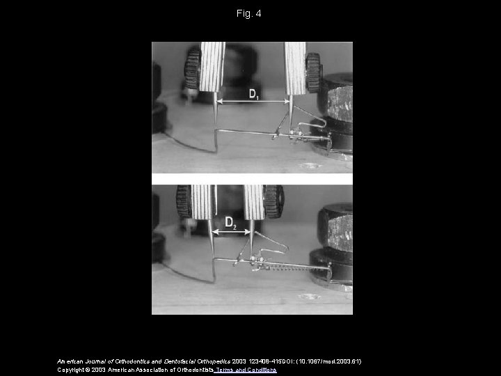 Fig. 4 American Journal of Orthodontics and Dentofacial Orthopedics 2003 123408 -415 DOI: (10.